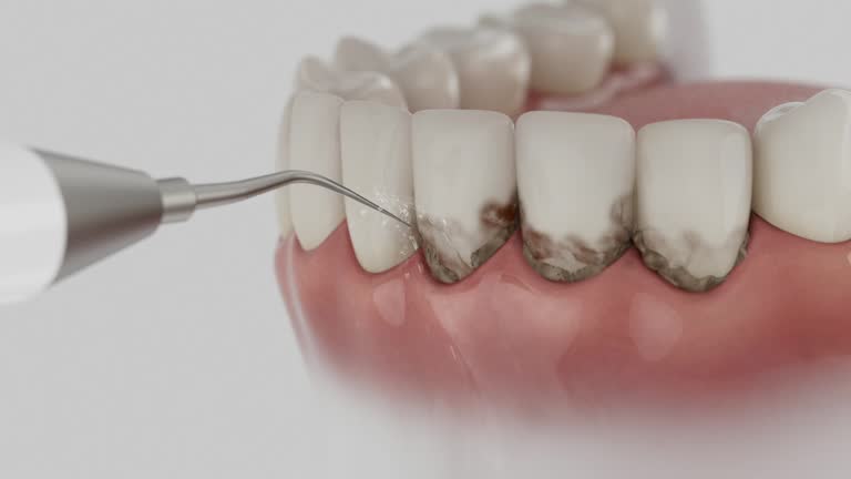 Reliable Dental contractor in Bismarck, MO by Dentist Open Now